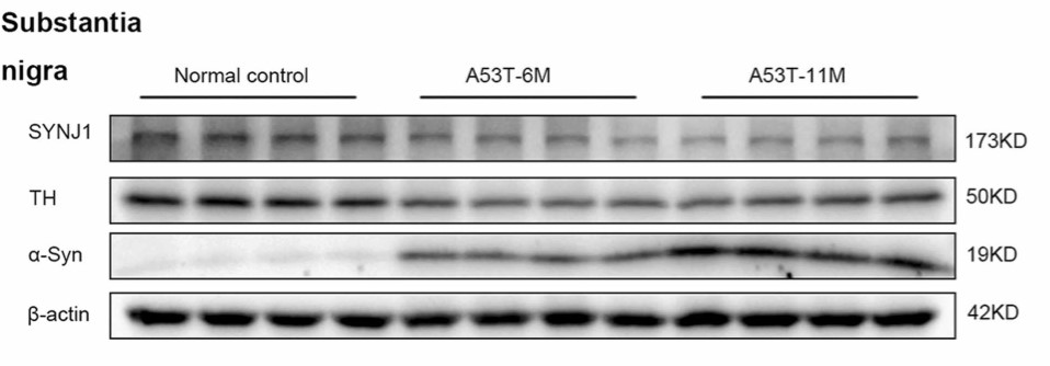 Western blot analysis of SYNJ1.jpg